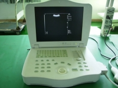 Scanner à ultrasons entièrement numérique pour ordinateur portable