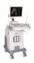Scanner à ultrasons pour chariot Full-Digital avec affichage LCD 15 pouces HD