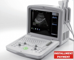 Scanner à ultrasons entièrement numérique
