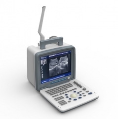 Scanner à ultrasons portable LED