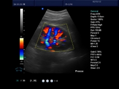 Scanner Doppler couleur portable