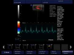 Scanner Doppler couleur portable