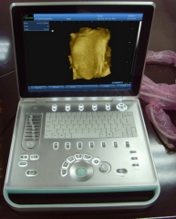 Scanner à ultrasons Portable B multi-langues