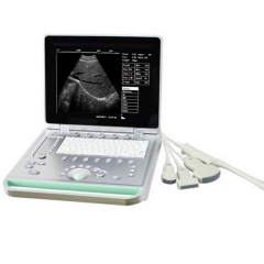 Scanner à ultrasons portable B pour ordinateur portable
