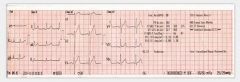 12e route 12e Guide ECG Monitor
