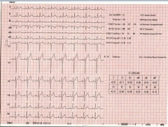 12e route 12e Guide ECG Monitor
