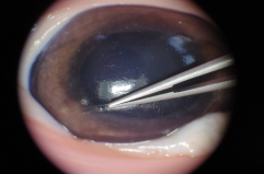 Microsurgery training simulator of ophthalmology, Microscope,instruments and Silicone facial model