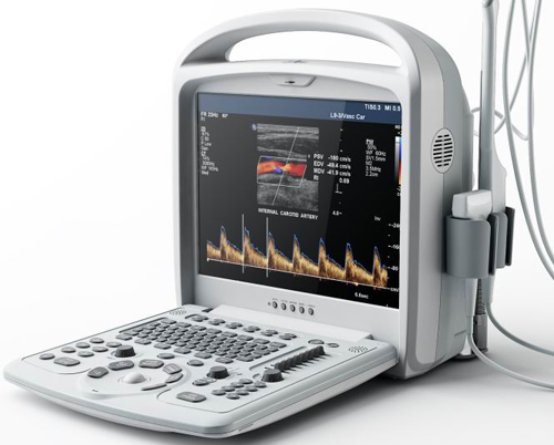 Scanner Doppler couleur portable