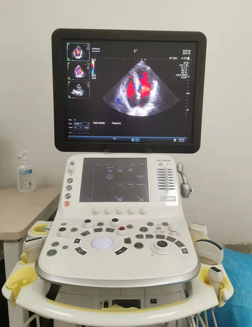 Échographe Cardiaque Made in China